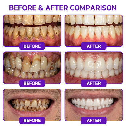 🦷𝐍𝐚𝐭𝐫𝐚𝐯𝐨𝐫® VioCore Bee Venom Gingivitis & Periodontitis Treatment Toothpaste